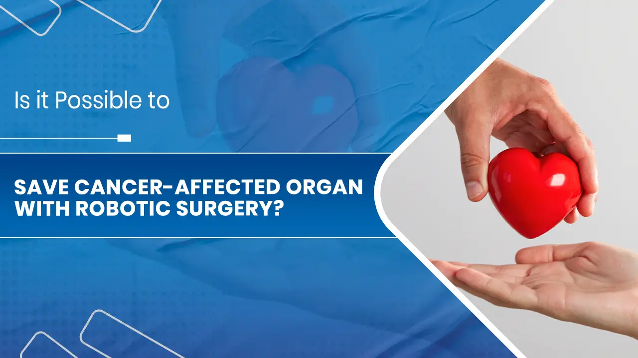 Save Cancer-affected Organ