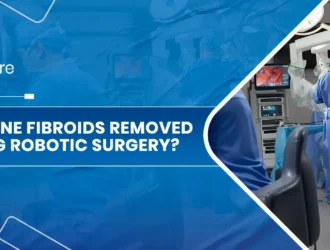 Uterine Fibroids Removed using Robotic Surgery