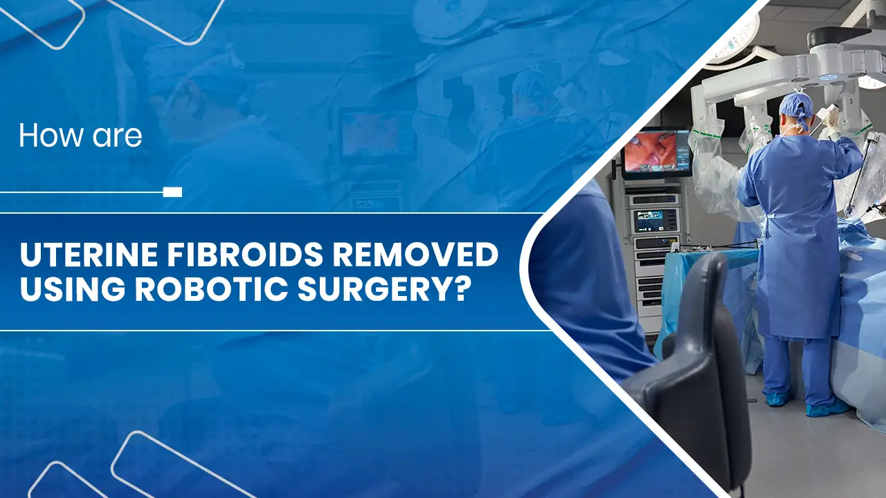 Uterine Fibroids Removed using Robotic Surgery