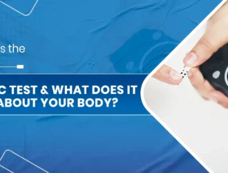 What is the HbA1c Test