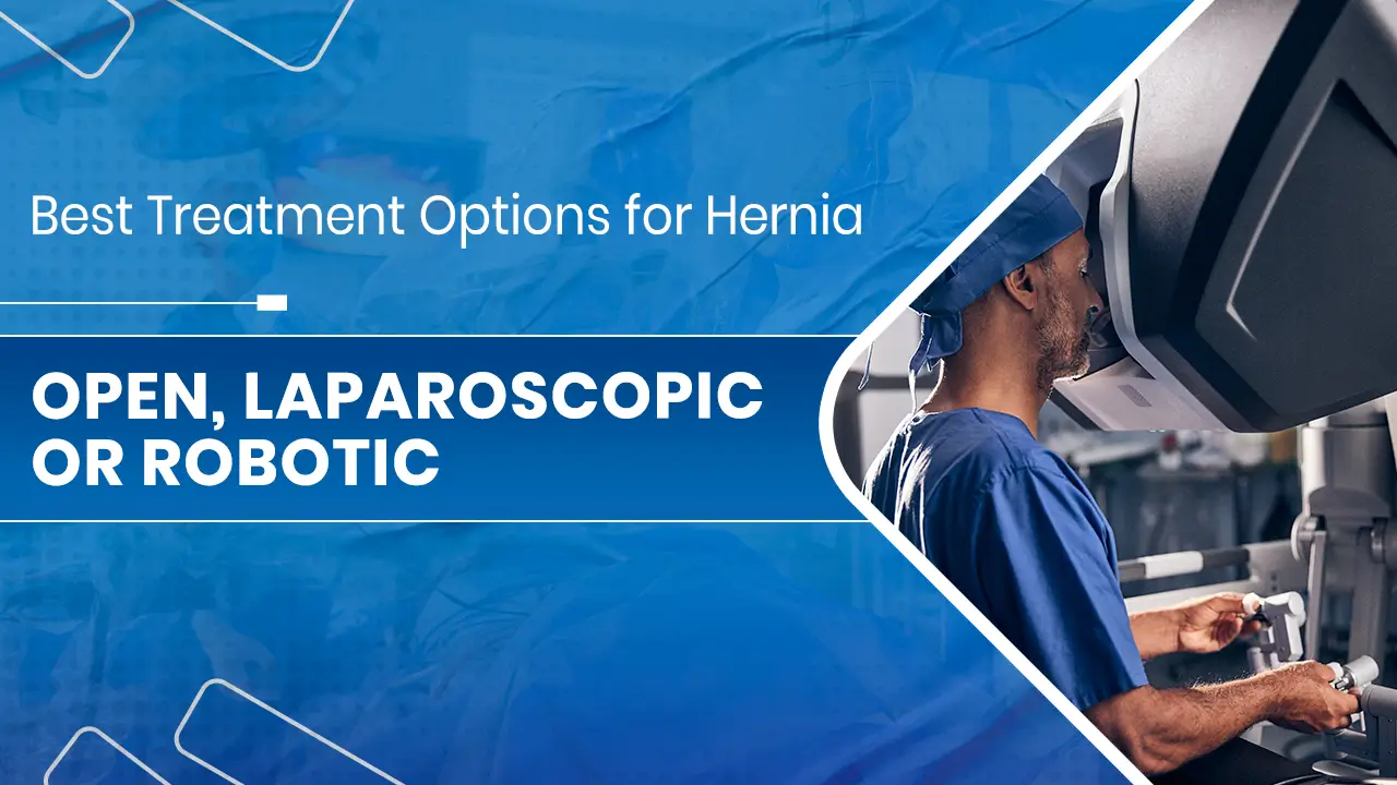 Best Treatment Options for Hernia