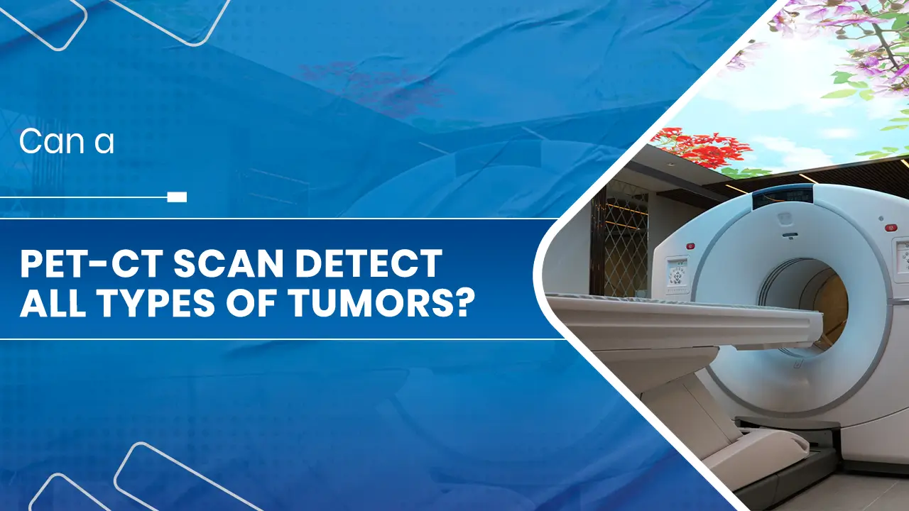 Can a PET-CT Scan
