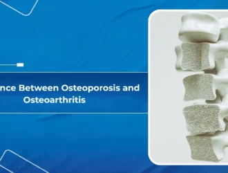 Difference Between Osteoporosis and Osteoarthritis