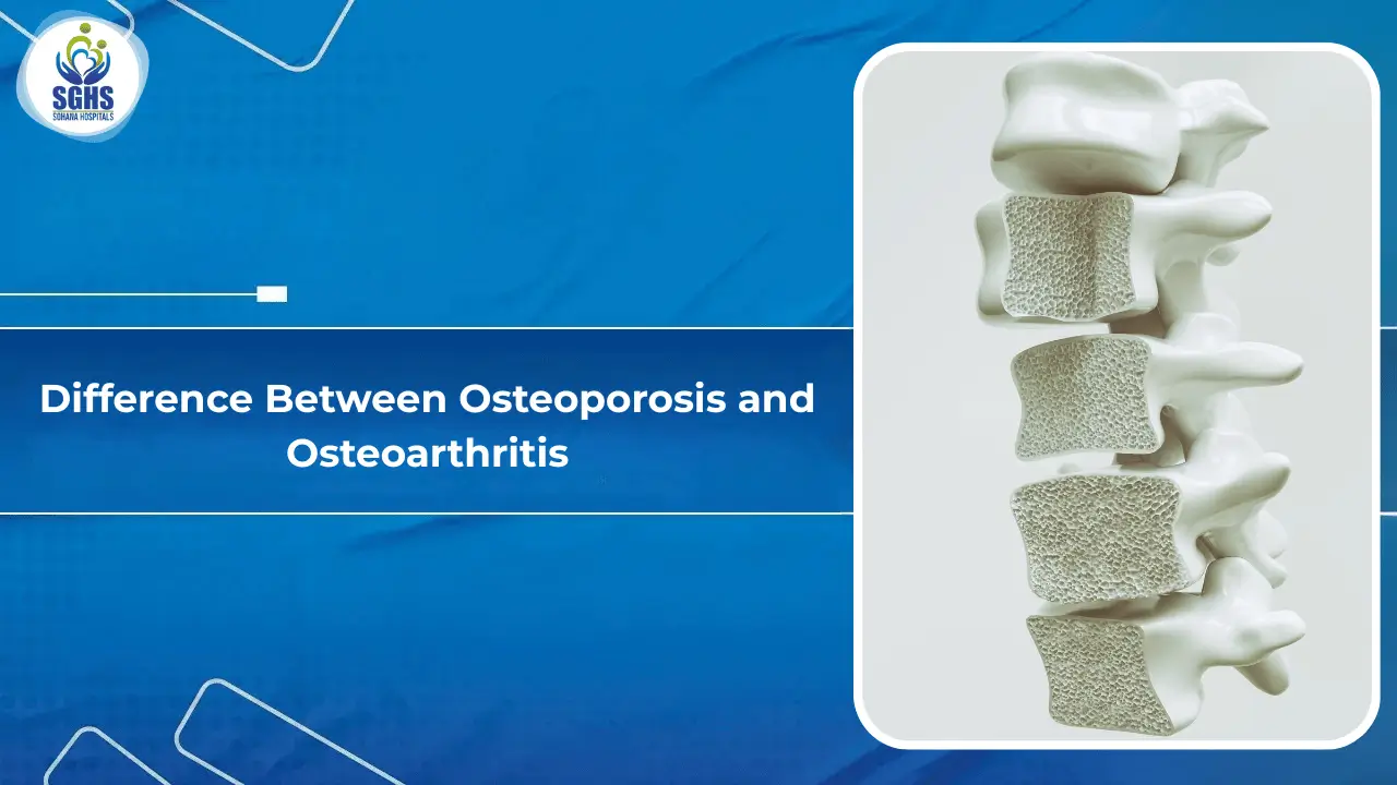 Difference Between Osteoporosis and Osteoarthritis