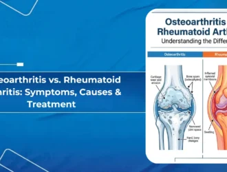 Osteoarthritis vs. Rheumatoid Arthritis - Symptoms, Causes & Treatment