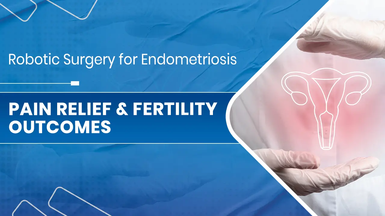 Robotic Surgery for Endometriosis