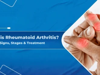 What is Rheumatoid Arthritis? Signs, Stages & Treatment