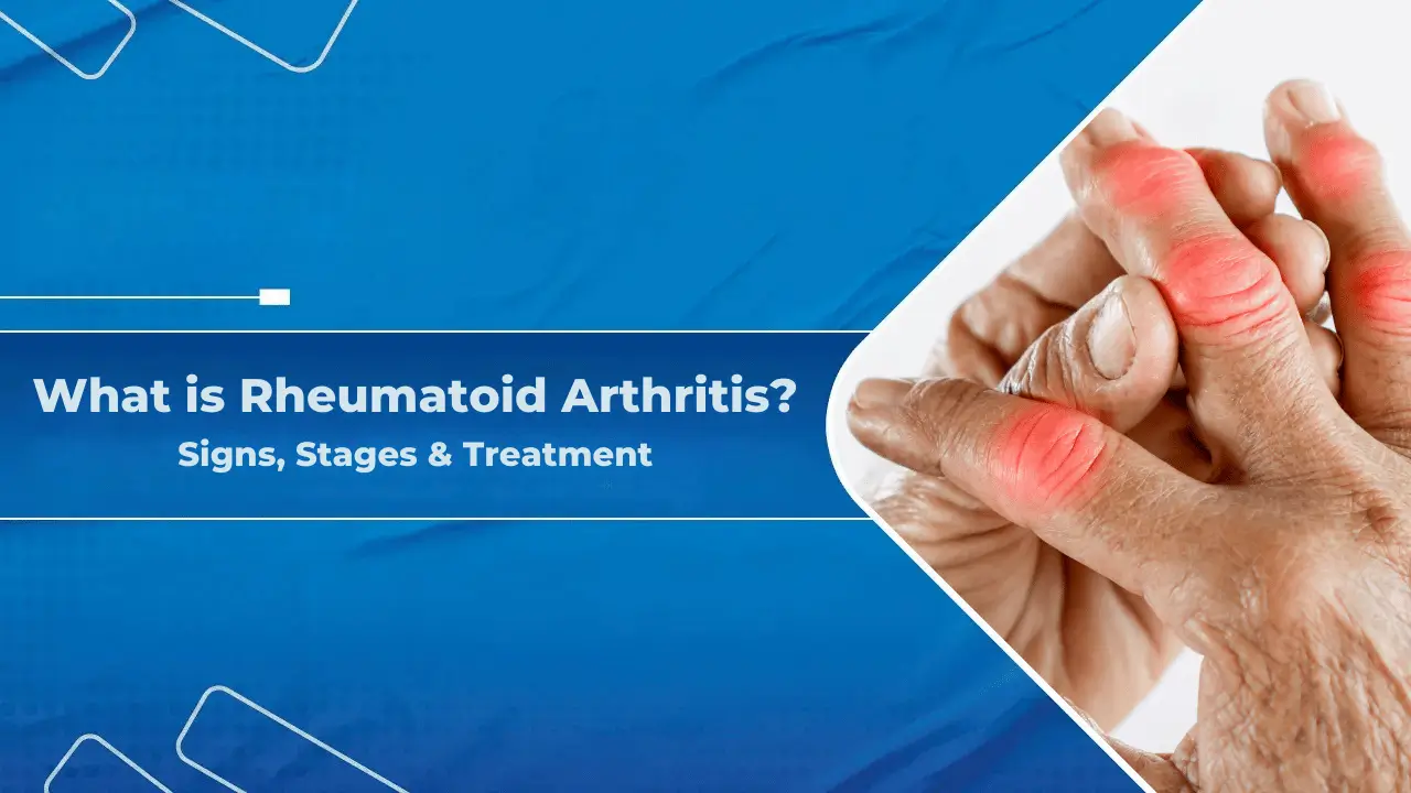 What is Rheumatoid Arthritis? Signs, Stages & Treatment