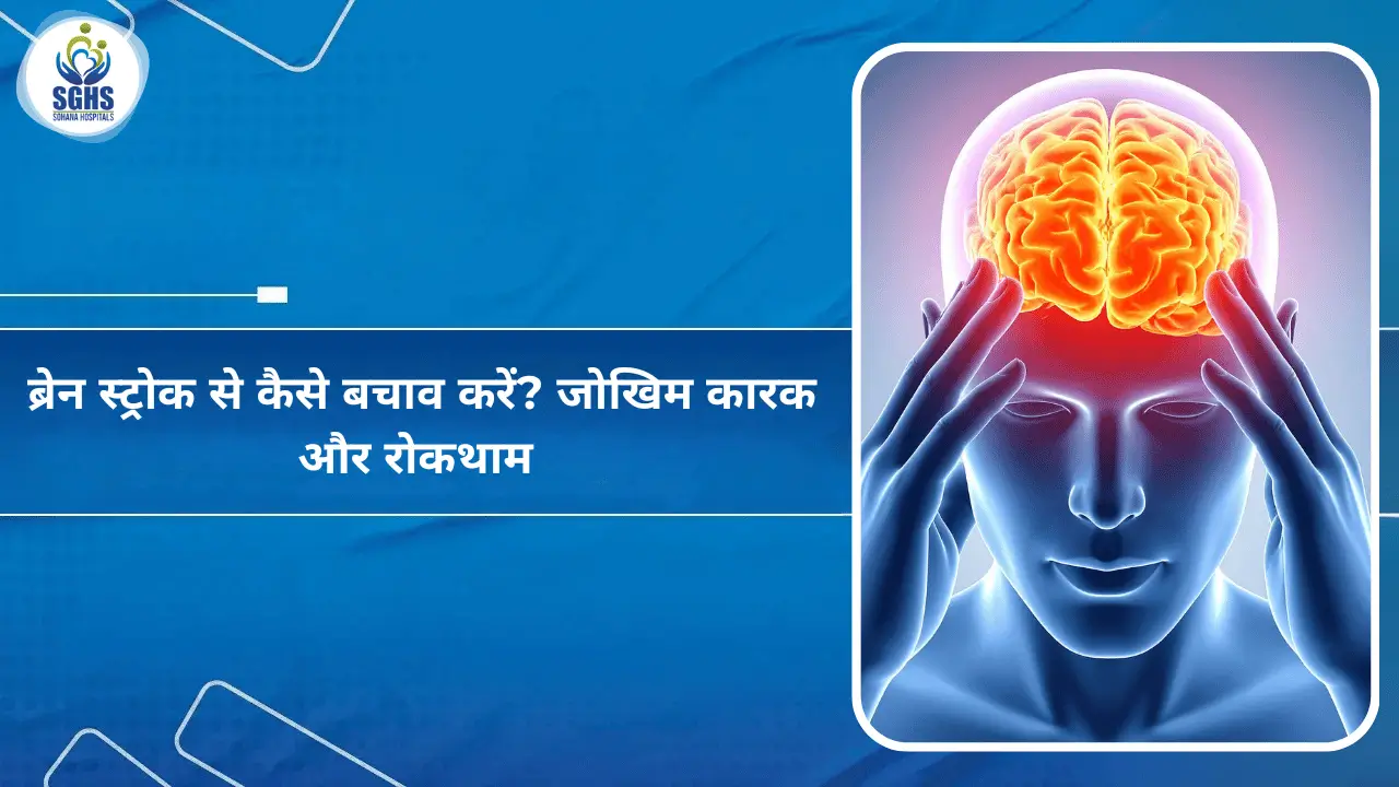 ब्रेन स्ट्रोक से कैसे बचें जोखिम कारक और बचाव के तरीके