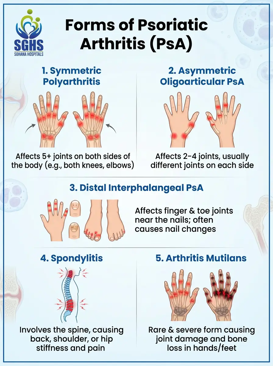 Psoriatic Arthritis Forms