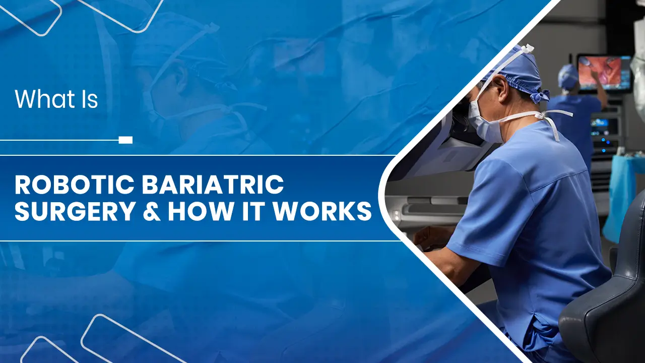 Robotic Bariatric Surgery