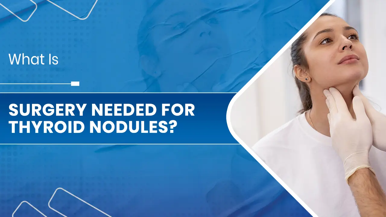 Surgery Needed for Thyroid Nodules.jpg