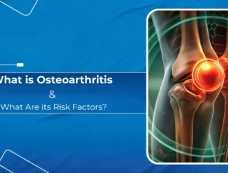 What is Osteoarthritis and What Are its Risk Factors