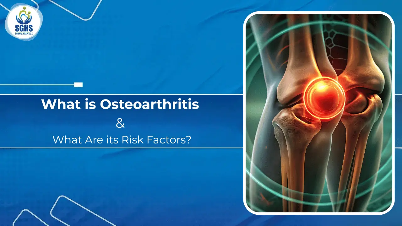 What is Osteoarthritis and What Are its Risk Factors
