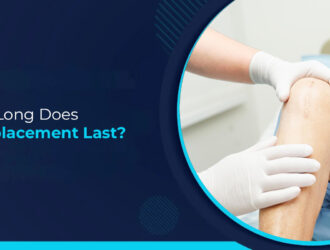 How Long Does a Knee Replacement Last?