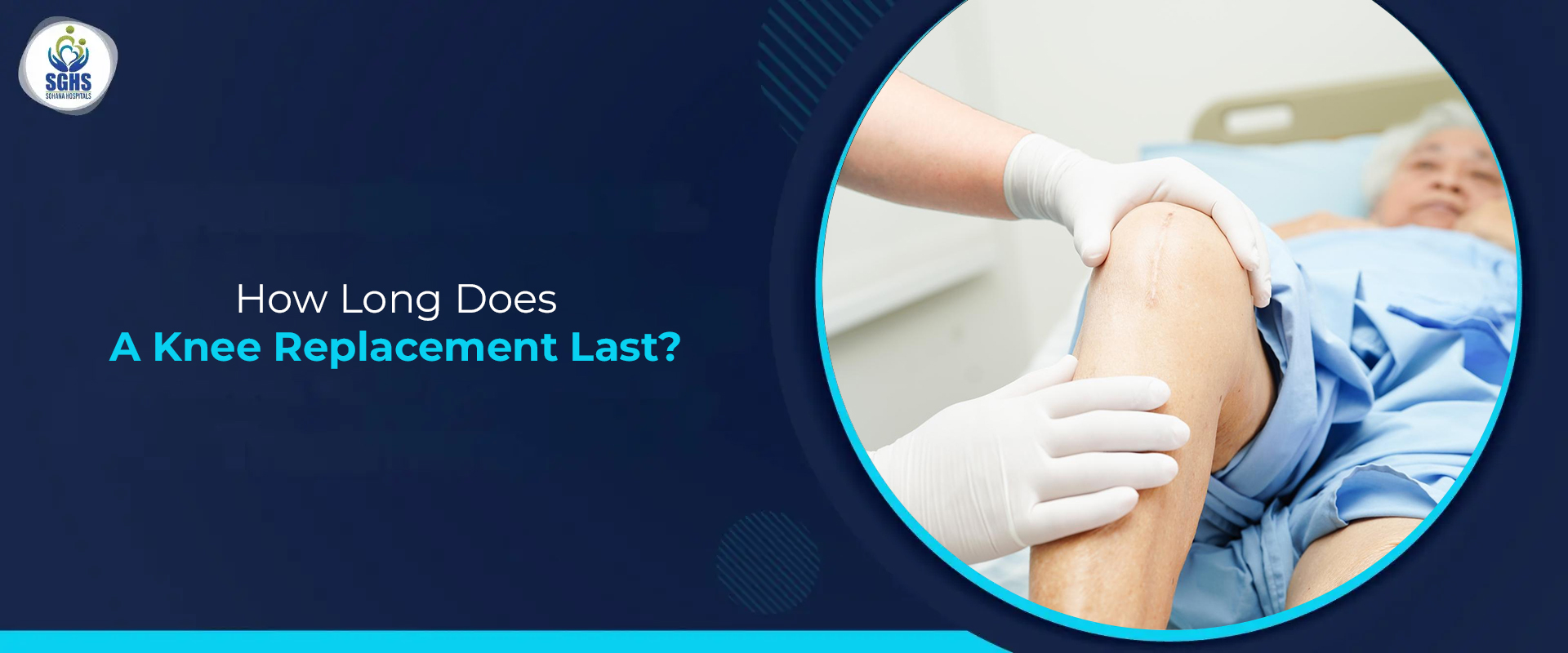 How Long Does a Knee Replacement Last?