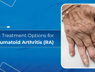 Best Treatment Options for Rheumatoid Arthritis (RA)
