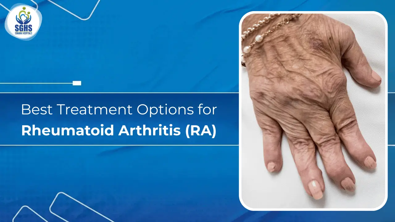 Best Treatment Options for Rheumatoid Arthritis (RA)