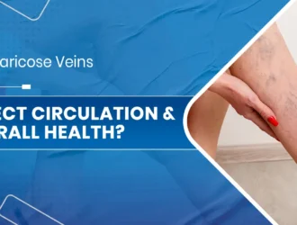 Can Varicose Veins Affect.jpg