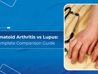Rheumatoid Arthritis vs Lupus - A Complete Comparison Guide