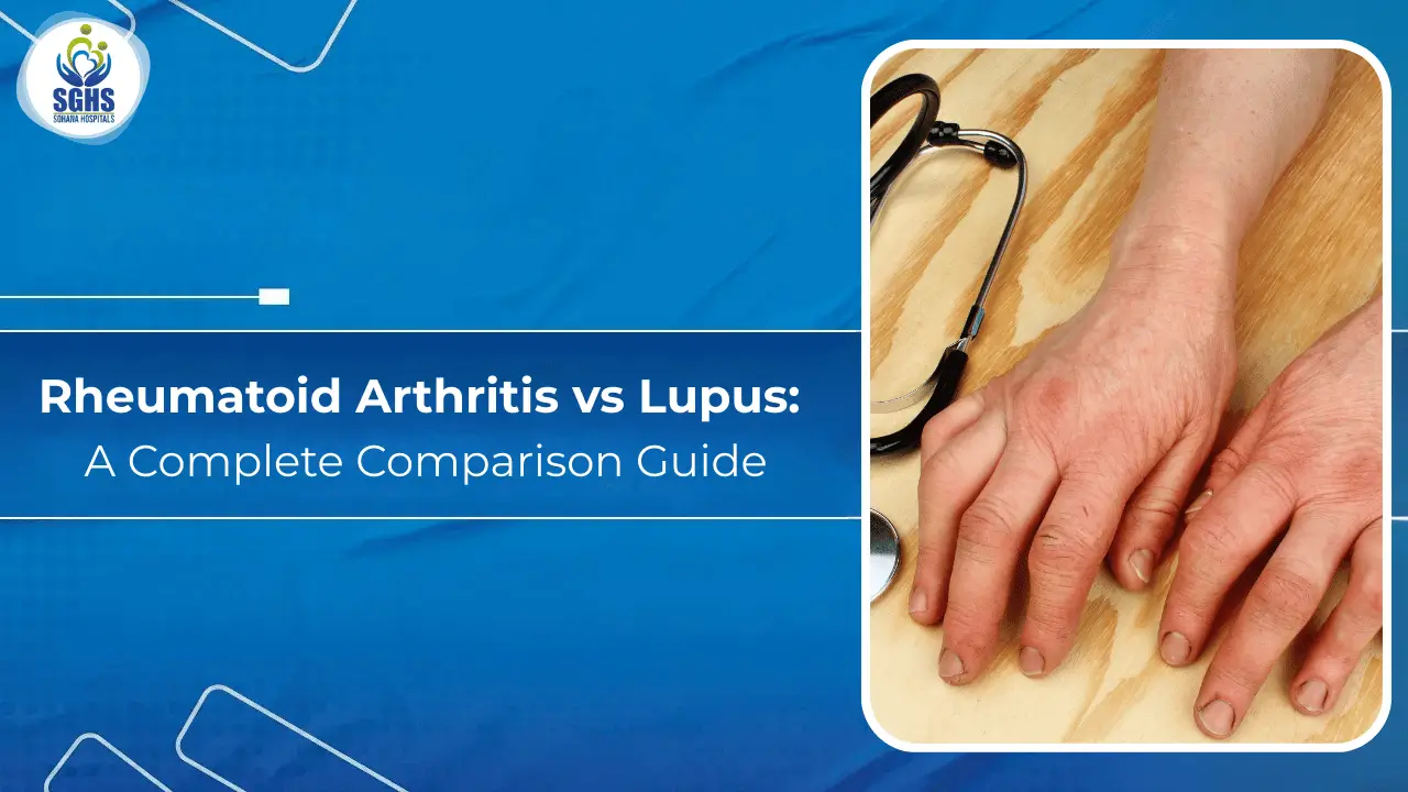 Rheumatoid Arthritis vs Lupus - A Complete Comparison Guide