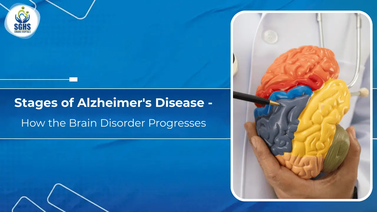 Stages of Alzheimer's Disease - How the Brain Disorder Progresses