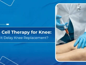 Stem Cell Therapy for Knee