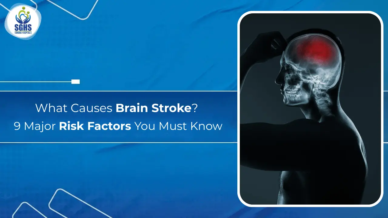 What Causes Brain Stroke - 9 Major Risk Factors You Must Know