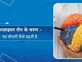 अल्ज़ाइमर रोग के चरण – यह बीमारी कैसे बढ़ती है