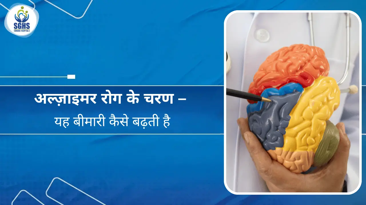 अल्ज़ाइमर रोग के चरण – यह बीमारी कैसे बढ़ती है
