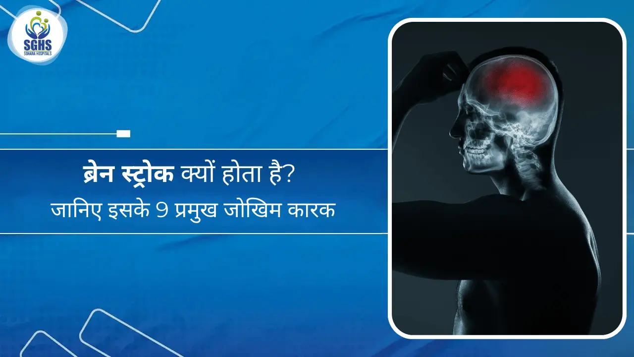 ब्रेन स्ट्रोक क्यों होता है जानिए इसके 9 प्रमुख जोखिम कारक