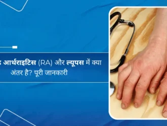 रूमेटाइड आर्थराइटिस (RA) और ल्यूपस में क्या अंतर है पूरी जानकारी