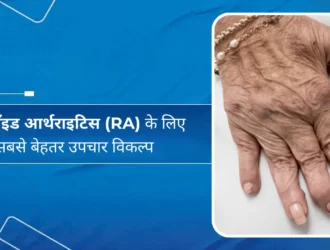 रूमेटॉइड आर्थराइटिस (RA) के लिए सबसे बेहतर उपचार विकल्प