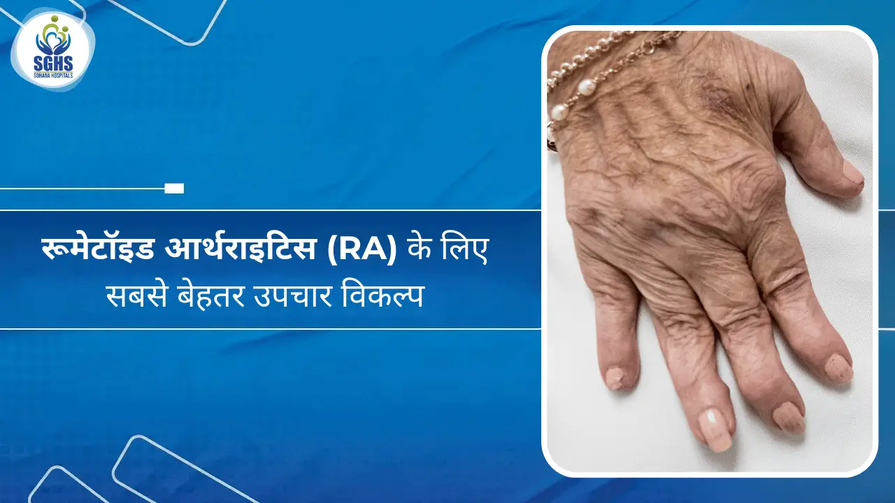 रूमेटॉइड आर्थराइटिस (RA) के लिए सबसे बेहतर उपचार विकल्प