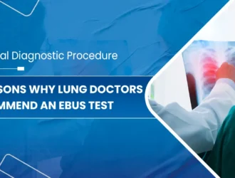 5-Reasons-Why-Lung-Doctors-Recommend-an-EBUS-Test
