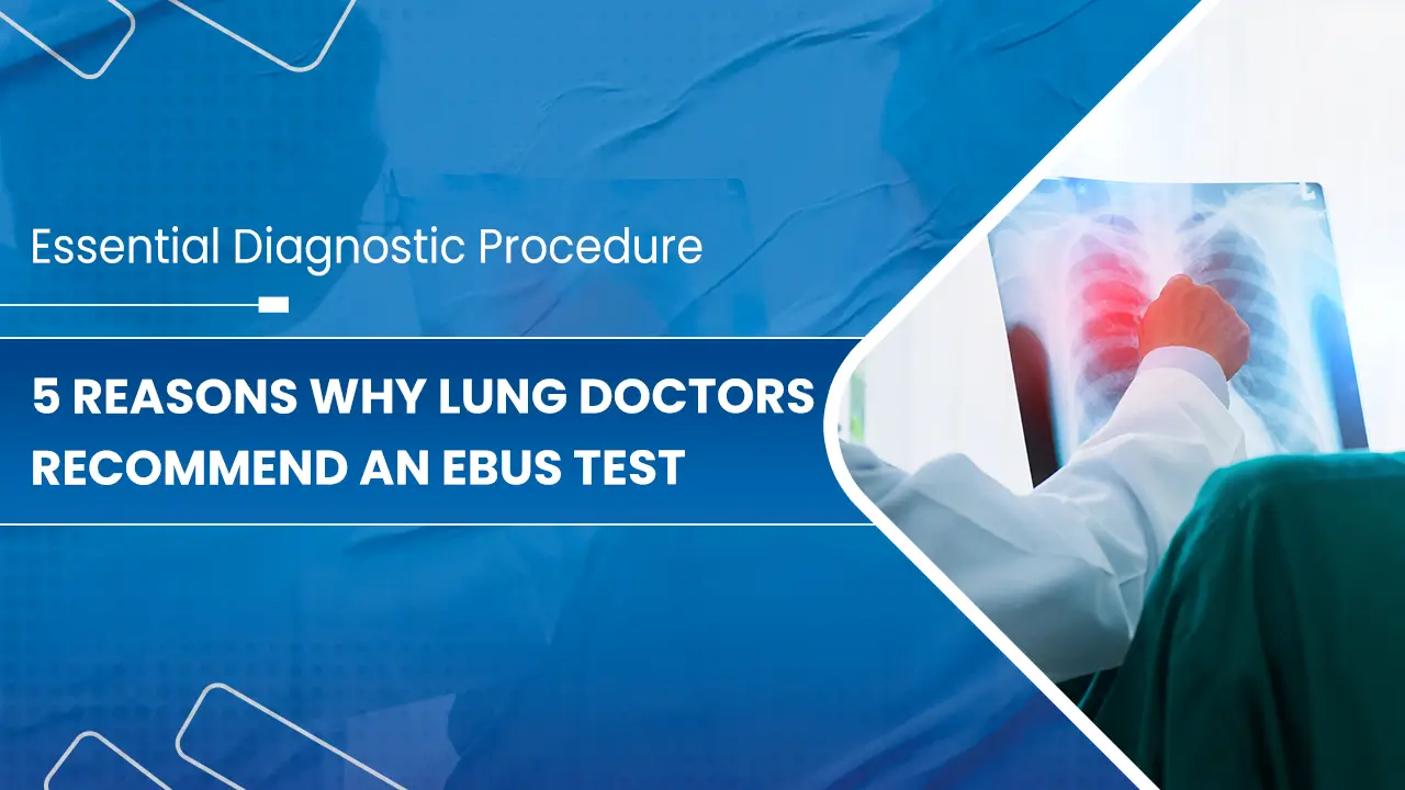 5-Reasons-Why-Lung-Doctors-Recommend-an-EBUS-Test