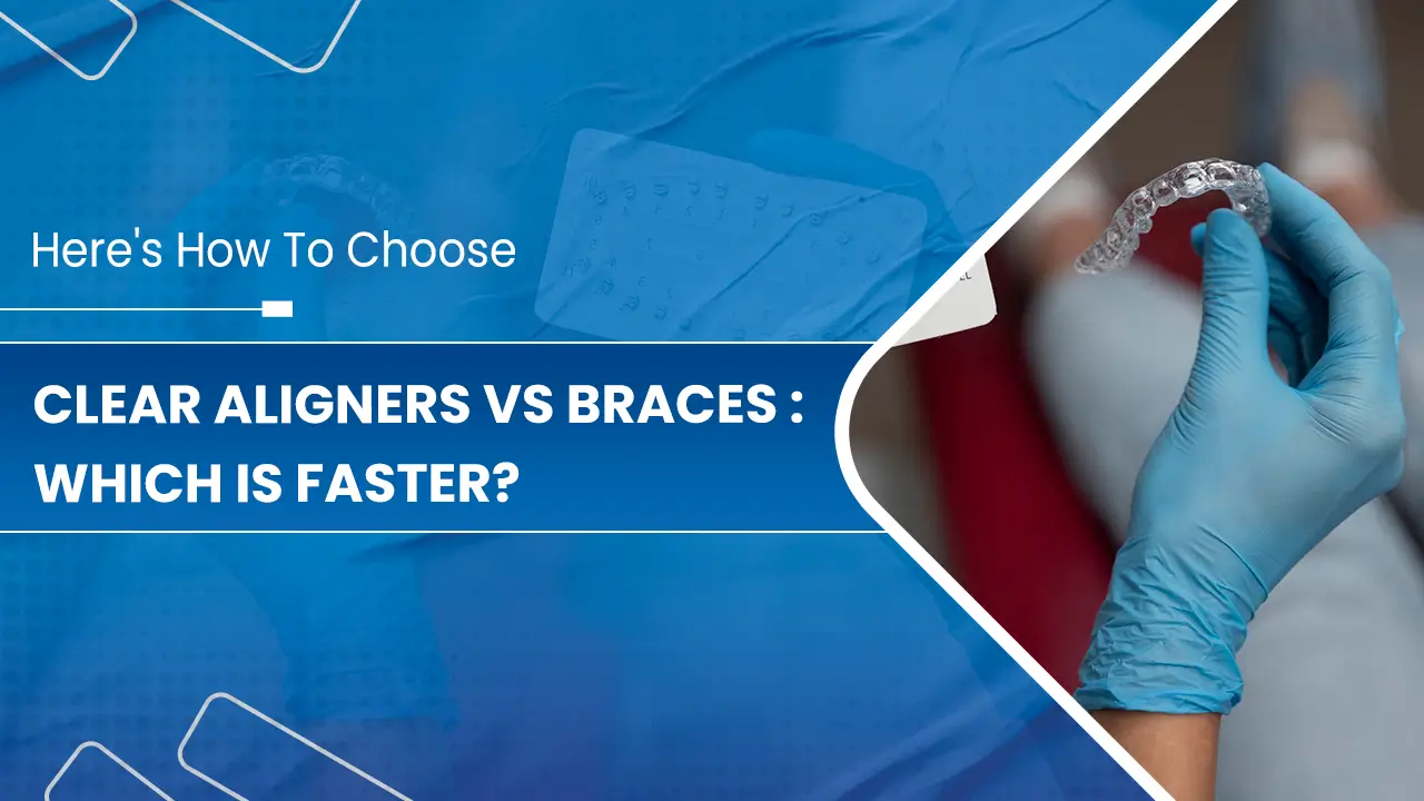 Clear-Aligners-vs-Braces--Which-is-Faster