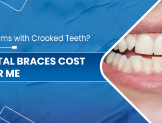 Dental-Braces-Cost-Near-Me-