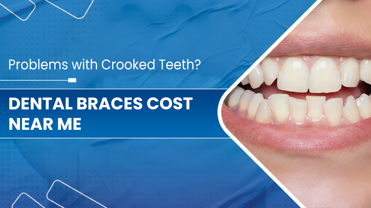 Dental-Braces-Cost-Near-Me-