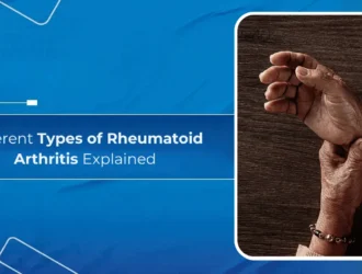 Types of Rheumatoid Arthritis