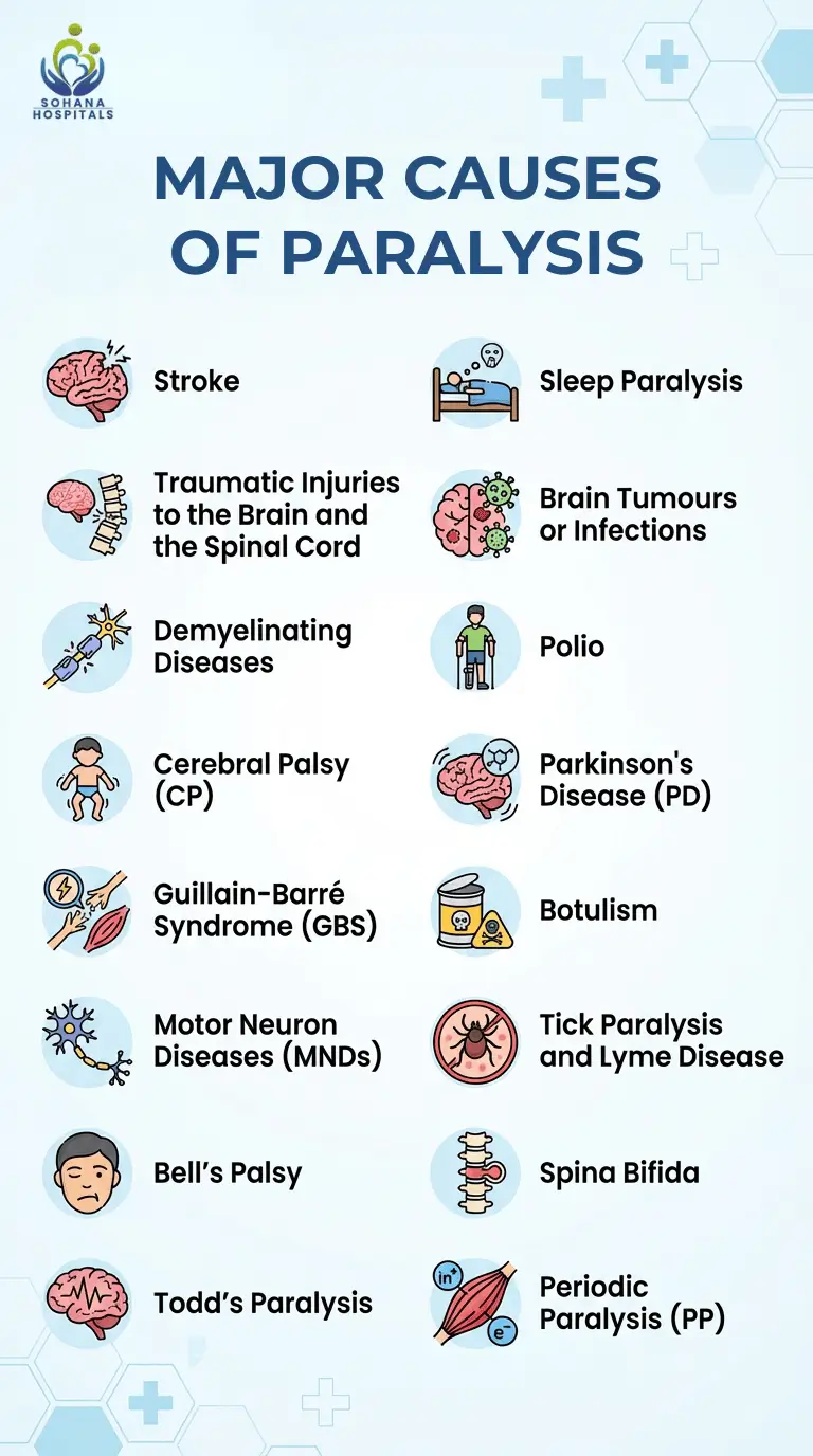Major Causes of Paralysis: Stroke - Traumatic Injuries to the Brain and the Spinal Cord - Demyelinating Diseases - Cerebral Palsy (CP) - Guillain-Barré Syndrome (GBS) - Motor Neuron Diseases (MNDs) - Bell’s Palsy - Todd’s Paralysis - Sleep Paralysis - Brain Tumours or Infections - Polio - Parkinson’s Disease (PD) - Botulism - Tick Paralysis and Lyme Disease - Spina Bifida - Periodic Paralysis (PP)