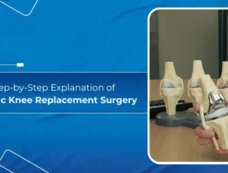 Step-by-Step Explanation of Robotic Knee Replacement Surgery