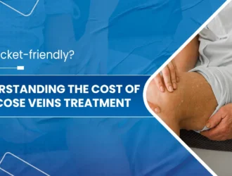 Understanding-the-Cost-of-Varicose-Veins-Treatment