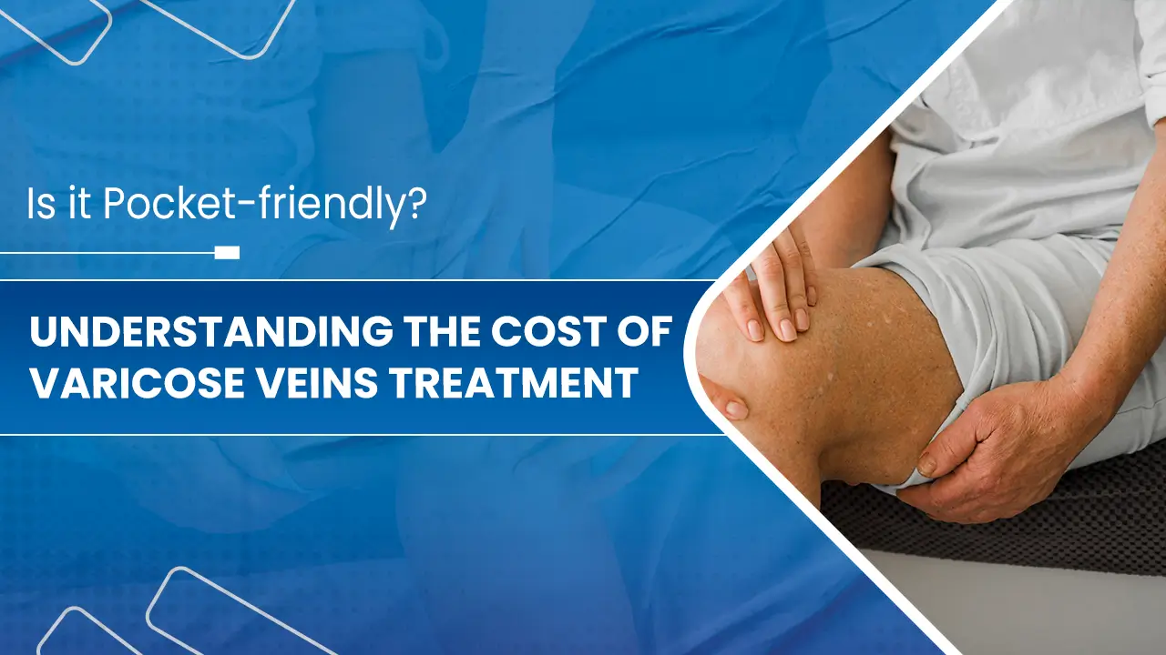 Understanding-the-Cost-of-Varicose-Veins-Treatment