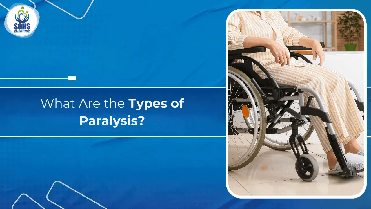 What Are the Types of Paralysis