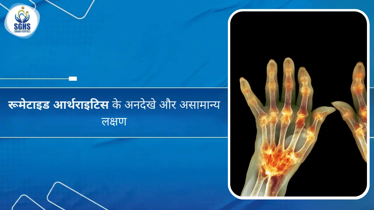 रूमेटाइड आर्थराइटिस के अनदेखे और असामान्य लक्षण