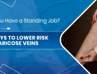 5 Ways to Lower Risk of Varicose Veins.jpg
