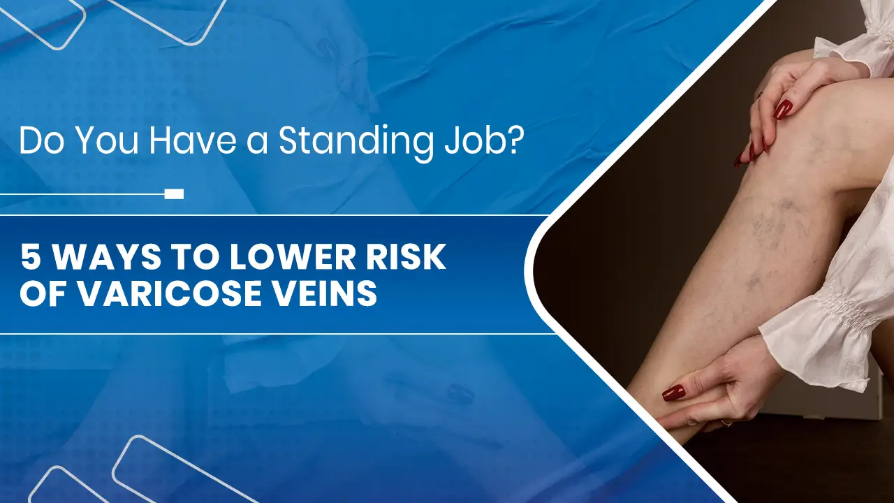 5 Ways to Lower Risk of Varicose Veins.jpg