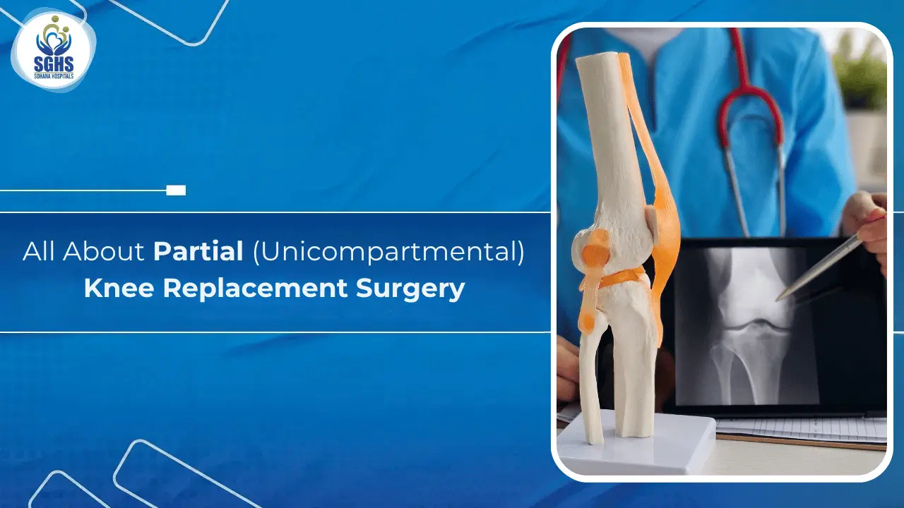 All About Partial (Unicompartmental) Knee Replacement Surgery