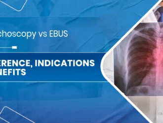 Bronchoscopy vs EBUS.jpg